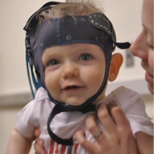 baby with headgear on being held by mother